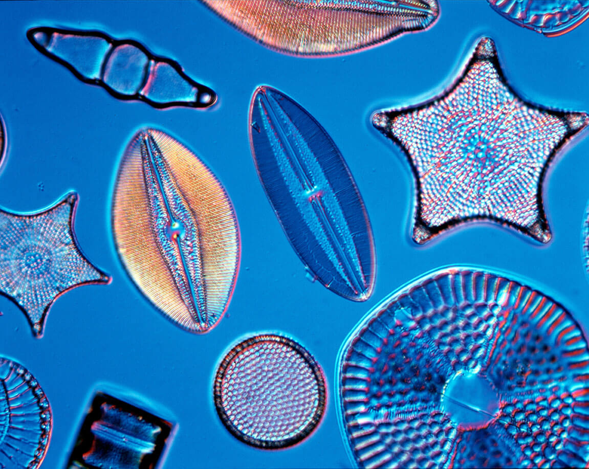 Diatoms. Credit: The Natural History Museum / Alamy Stock Photo.